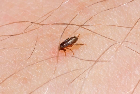 bed bug bites vs flea bites