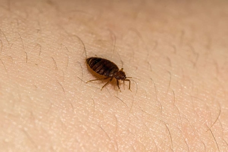 bed bug bites