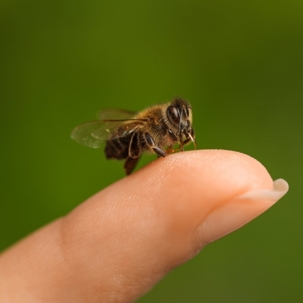 bee stings