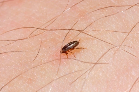 how to get rid of fleas