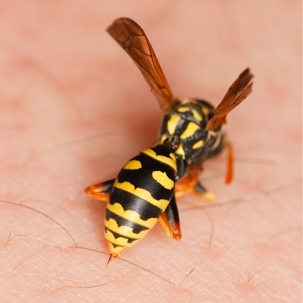 wasp stings