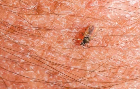 gnat biting a human